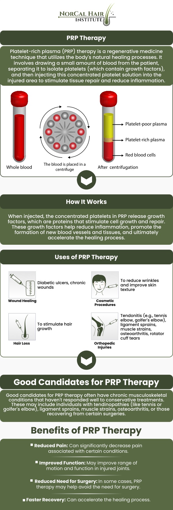 PRP (Platelet-Rich Plasma) treatment is an advanced, non-surgical procedure that can significantly enhance your hair restoration journey. By utilizing your own blood to isolate growth factors, PRP stimulates hair follicles and promotes new hair growth, improving the overall quality and thickness of your hair. Dr. Sadeeq Sadiq at NorCal Hair Institute uses the latest PRP techniques to customize treatments for each patient, ensuring that your hair restoration journey is effective and long-lasting. Contact us today or schedule an appointment online for expert hair restoration treatments. Conveniently located at 1561 Creekside Dr Suite 140 in Folsom, CA.