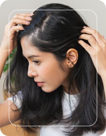 Female Hair Transplant Clinic in Folsom, CA