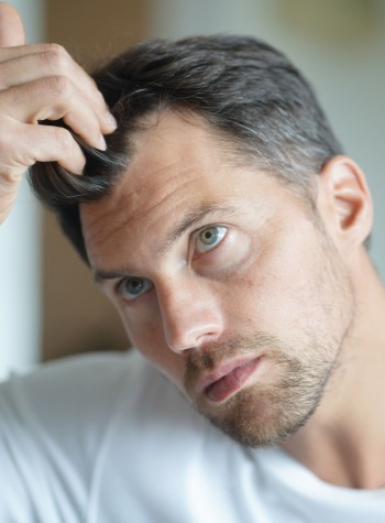 Hair Restoration Near Me in Folsom, CA