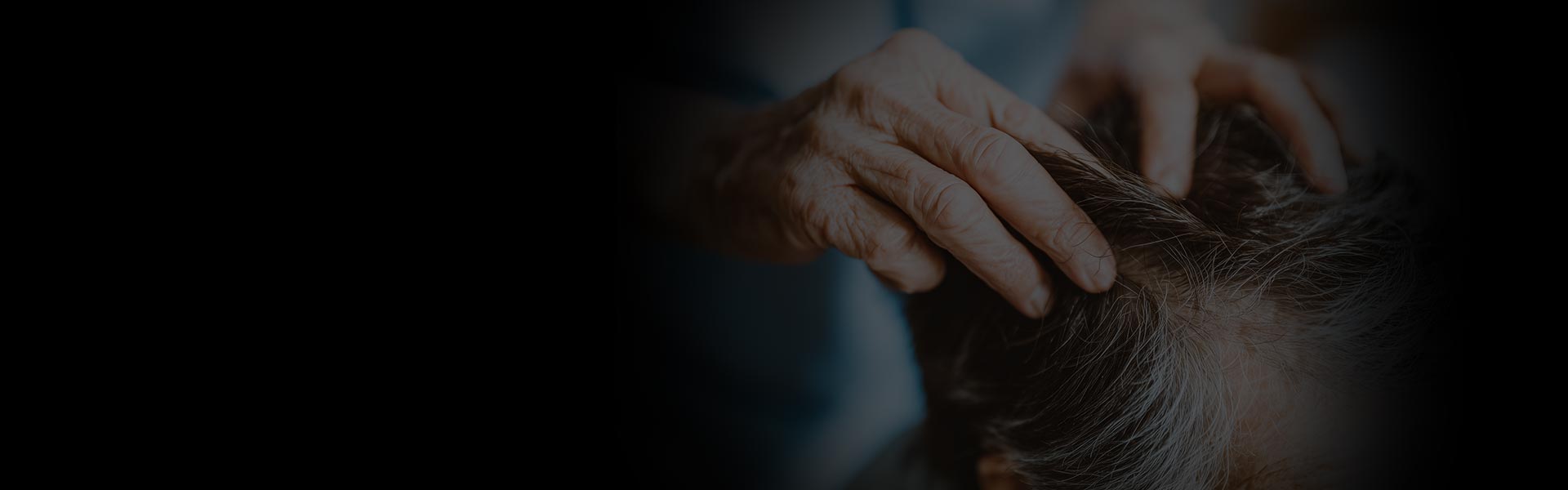 Hair Treatments at NorCal Hair Institute