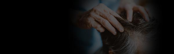 Hair Treatments at NorCal Hair Institute