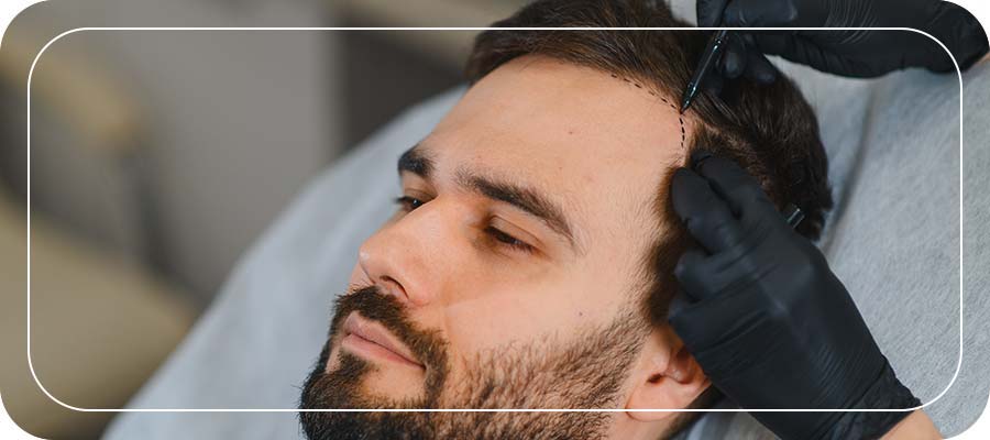 Hair Restoration Appointment at NorCal Hair Institute in Folsom, CA